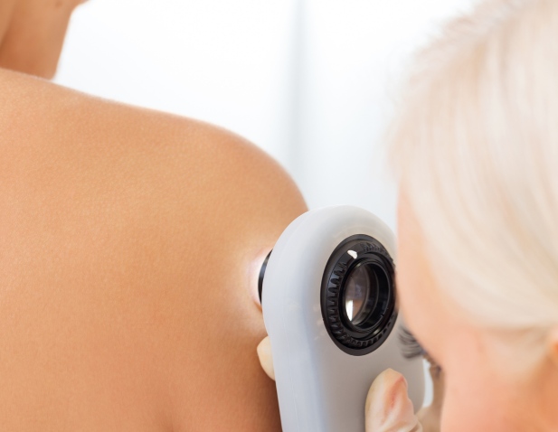 Clinical skin check of patient shoulder by clinician