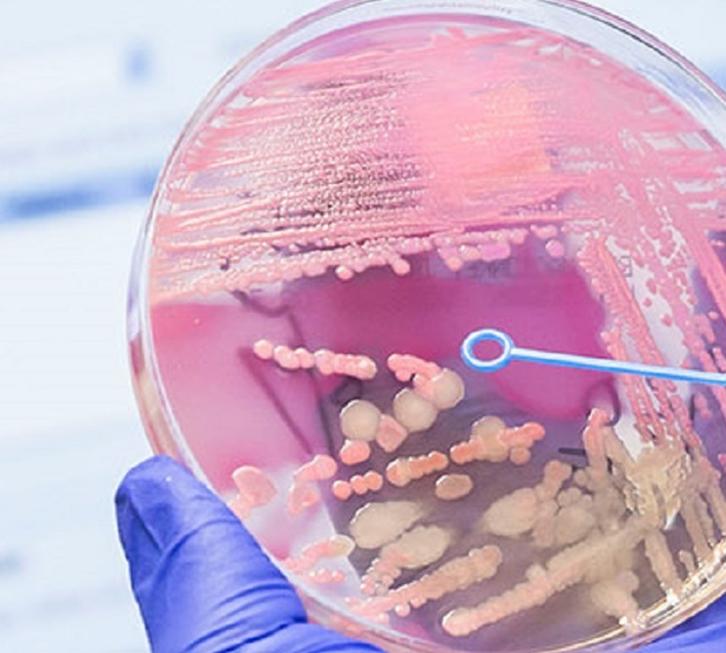Gloved hand holding a petri dish with bacterial cultures during a laboratory test.